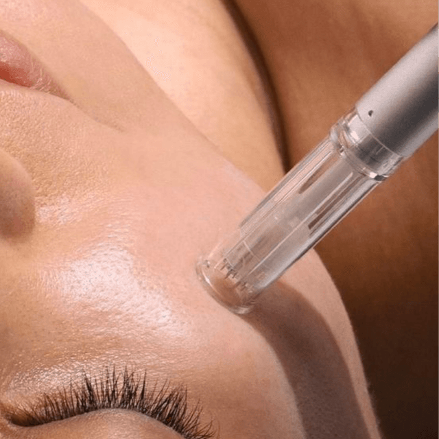 Microneedling at The Glo Haus Atlanta in Atlanta, GA